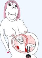 2soyjaks abortion arm baby blood breasts child death female full_body glasses hand leg medium_breasts naked nipple nsfw painted_nails pregnant scared scissors smile soyjak stubble subvariant:gapejak_female subvariant:wholesome_soyjak variant:gapejak variant:soyak // 793x1089 // 178.1KB